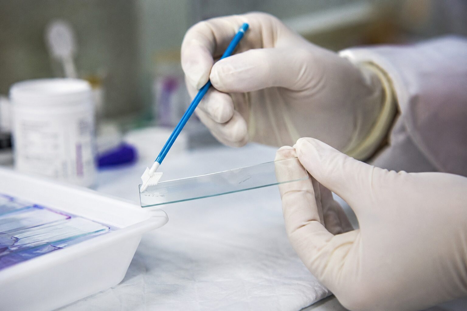 Citología y prueba del VPH