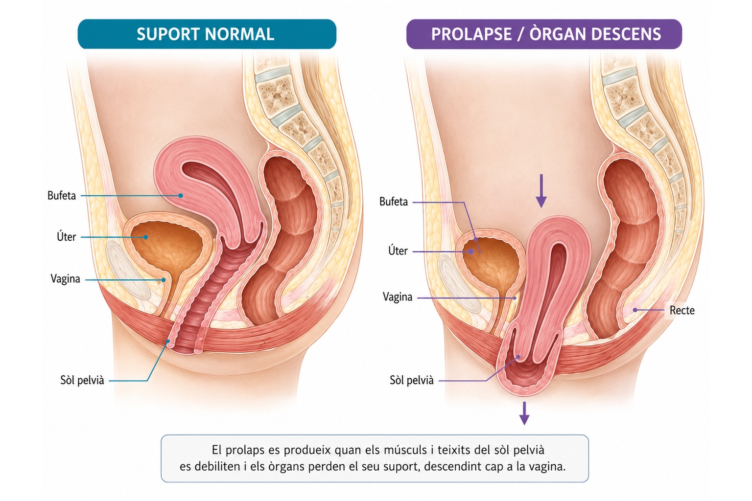 Suport normal dels òrgans pelvians i prolapse